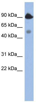 WB Suggested Anti-BCL2L13 Antibody Titration: 0.2-1 ug/ml; ELISA Titer: 1:312500; Positive Control: NCI-H226 cell lysateBCL2L13 is supported by BioGPS gene expression data to be expressed in NCIH226