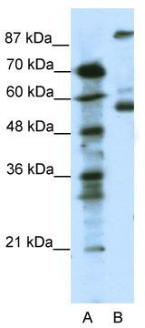 WB Suggested Anti-HTR7 Antibody Titration: 0.125 ug/ml; ELISA Titer: 1:1562500; Positive Control: Jurkat cell lysate