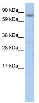 Host: Rabbit Target Name: DMD Sample Tissue: Human DLD1 Whole Cell lysates Antibody Dilution: 1ug/ml