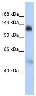 WB Suggested Anti-NFX1 Antibody Titration: 0.2-1 ug/ml; ELISA Titer: 1:312500; Positive Control: HepG2 cell lysate