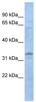 WB Suggested Anti-LYL1 Antibody Titration: 0.2-1 ug/ml; Positive Control: 721_B cell lysateLYL1 is supported by BioGPS gene expression data to be expressed in 721_B