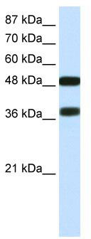 WB Suggested Anti-POU3F2 Antibody Titration: 0.2-1 ug/ml; Positive Control: Transfected 293T