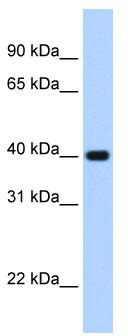 WB Suggested Anti-ZNF187 Antibody Titration: 2.5ug/ml; Positive Control: Transfected 293TZSCAN26 is supported by BioGPS gene expression data to be expressed in HEK293T