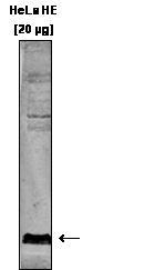 WB using the antibody against H3K9me3 diluted 1:750 in TBS-Tween containing 5% skimmed milk. The location of the protein of interest is indicated on the right.