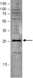 WB was performed on nuclear extracts from HeLa cells (HeLa NE, 20 ug) using the antibody against SAP30 diluted 1:1000 in TBS-Tween containing 5% skimmed milk. The molecular weight marker (in kDa) is shown on the left; the location of the protein of interest is indicated on the right.