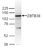 WB using the antibody against ZBTB38 diluted 1:1,000 in TBS-Tween containing 5% skimmed milk. The position of the protein of interest (expected size: 138 kDa) is indicated on the right; the marker (in kDa) is shown on the left.