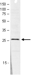 WB was performed on nuclear extracts from HeLa cells (HeLa NE, 20 ug) using the antibody against SAP30 diluted 1:1000 in TBS-Tween containing 5% skimmed milk. The molecular weight marker (in kDa) is shown on the left; the location of the protein of interest is indicated on the right.