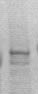 WB: The tissue extract derived from mouse spleen was immunoblotted by Rabbit anti-DBF4 at 1:500. An immunoreactive band is observed ~77 kDa.