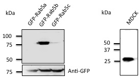 Anti-Rab5b Ab at 1/500 dilution; 293 cells transfected with GFP-Rab5; lysates at 50 ug per lane; rabbit polyclonal to goat IgG (HRP) at 1/10,000 dilution;