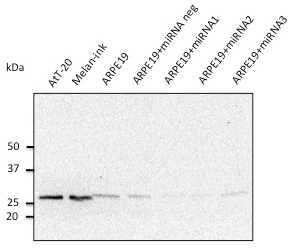 Anti-Rab27 antibody at 1/500 dilution; rabbit polyclonal to goat IgG (HRP) at 1/10,000 dilution;