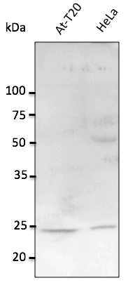 Anti-Rab11a Ab at 1/2, 500 dilution; lysates at 100 ug per lane; rabbit polyclonal to goat IgG (HRP) at 1/10,000 dilution;
