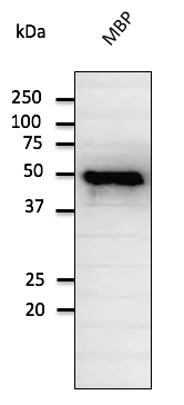 Anti-MBP Ab at 1/2,000 dilution; rabbit polyclonal to goat IgG (HRP) at 1/10,000 dilution;