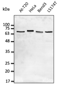 Anti-LMNA Ab at 1/2, 500 dilution; lysates at 50 ug per lane; rabbit polyclonal to goat IgG (HRP) at 1/10,000 dilution;