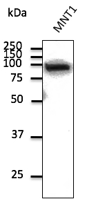 Anti-beta-Catenin Ab at 1/1,000 dilution; lysate at 100 ug per lane; Rabbit polyclonal to goat IgG (HRP) at 1/10,000 dilution;