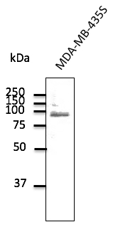 Anti-TLR2 Ab at 1/500 dilution; Rabbit polyclonal to goat IgG (HRP) at 1/10,000 dilution.