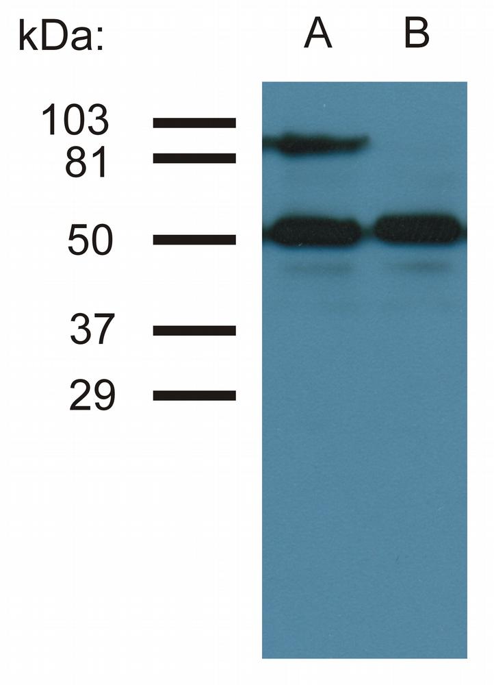 Western blottin analysis of CD54 expression in TNF-alpha activated (A) and nonactivated (B) HUVEC cells by antibody MEM-111. Lower bands represent tubulin as a loading control.