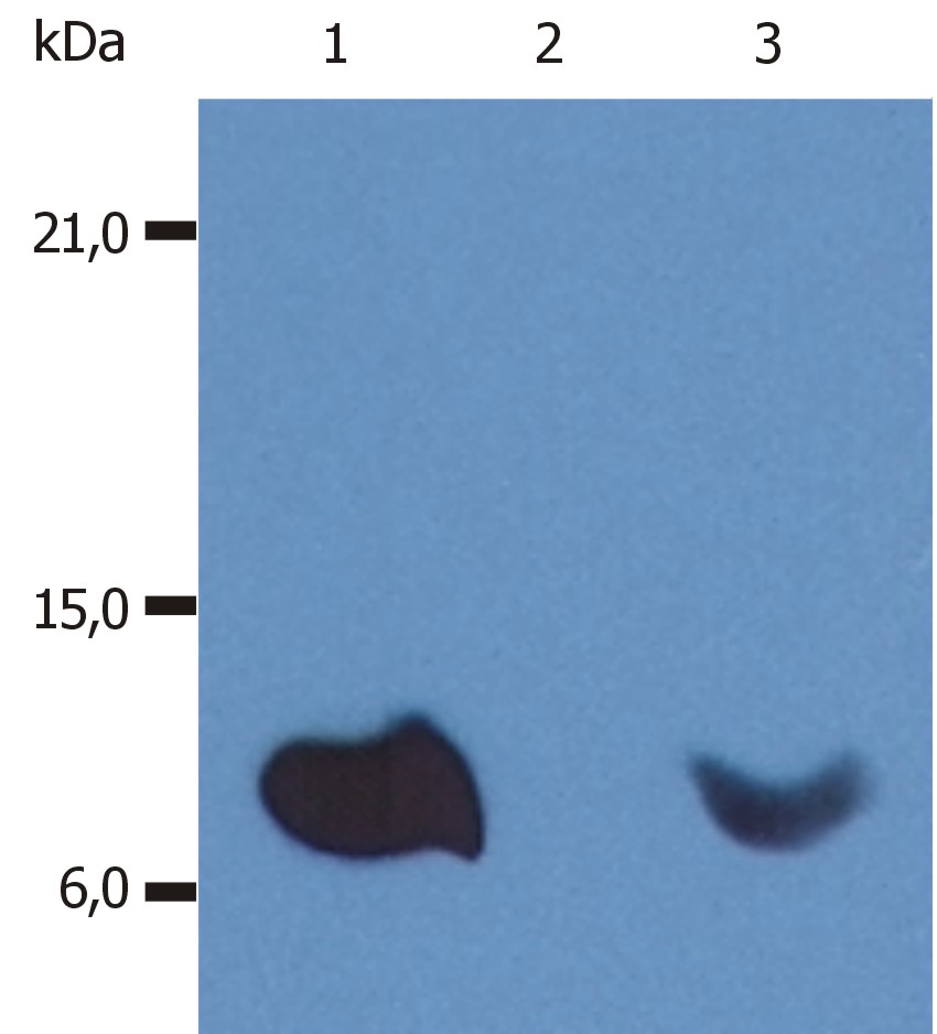 Western Blotting analysis (non-reducing conditions) of whole cell lysate of various cell lines using anti-human bata2-microglobulin (B2M-01). Lane 1: RAJI human Burkitt lymphoma cell line;Lane 2: EL4 mouse lymphoblastic lymphoma cell line;Lane 3: U937 human histiocytic lymphoma cell line