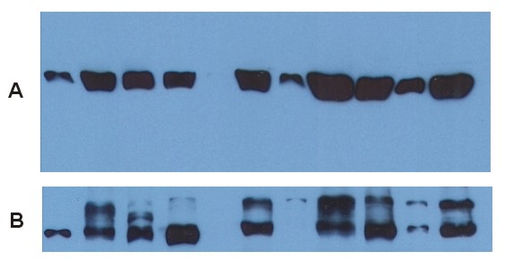 Use of anti-alpha-tubulin antibody TU-01 as a loading control (A) in an Western blotting experiment revealing the staining pattern of various cell lysates by a newly developed monoclonal antibody (B).