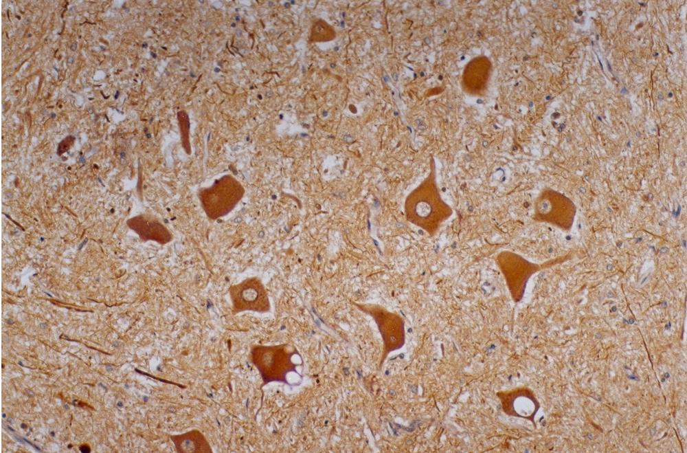 Immunohistochemistry staining of human cerebellum (paraffin-embedded sections) with anti-Neurofilament heavy protein (NF-01). Primary antibody: 5 ug/ml