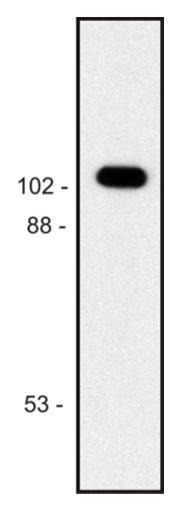 Western blot of purifiedE. colibeta-galactosidase sample; reduced sample, immunostained bymAbBG-02andgoat anti-mouse IgG (H+L)-HRPconjugate.