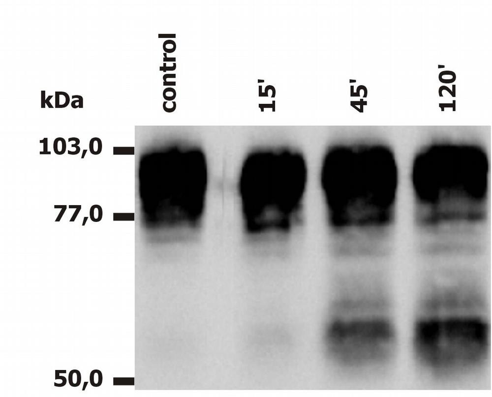 Western Blotting analysis of PMA-activated neutrophils (A) and monocytes (B), using anti-human CD18 (MEM-148). The antibody MEM-148 recognizes the lower 65 to 70 kDa zone (activation marker) as well as the upper 78 to 96 kDa zone (CD18).