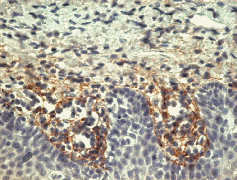 Immunohistochemistry staining of tonsil (paraffin-embedded sections) with anti-human Tenascin (T2H5).