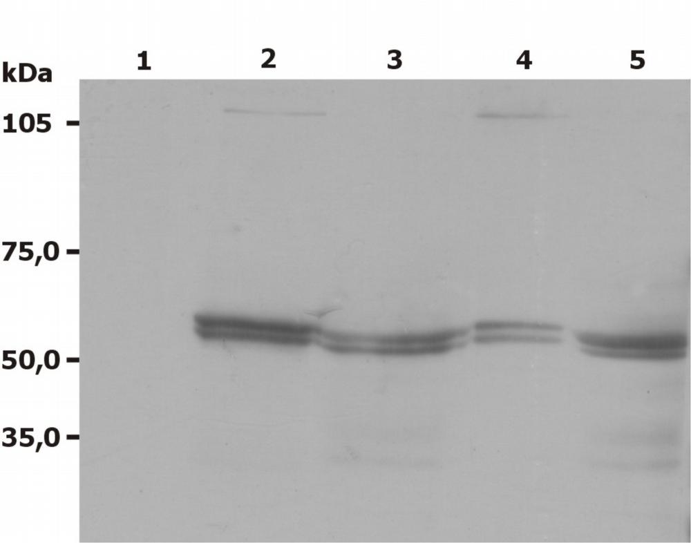 Western Blotting analysis (non-reducing conditions) of Lyn using anti-Lyn (LYN-01). Lane 1: negative control Lane 2: RBL rat basophilic leukemia cell line;Lane 3: JURKAT human peripheral blood T cell leukemia cell line;Lane 4: A-431 human epidermoid carcinoma cell line;Lane 5: U-937 human histiocytic lymphoma cell line