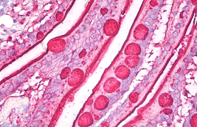 Immunohistochemistry staining of human small intestine (paraffin sections) using anti-blood group Lewis b (clone 2-25LE).