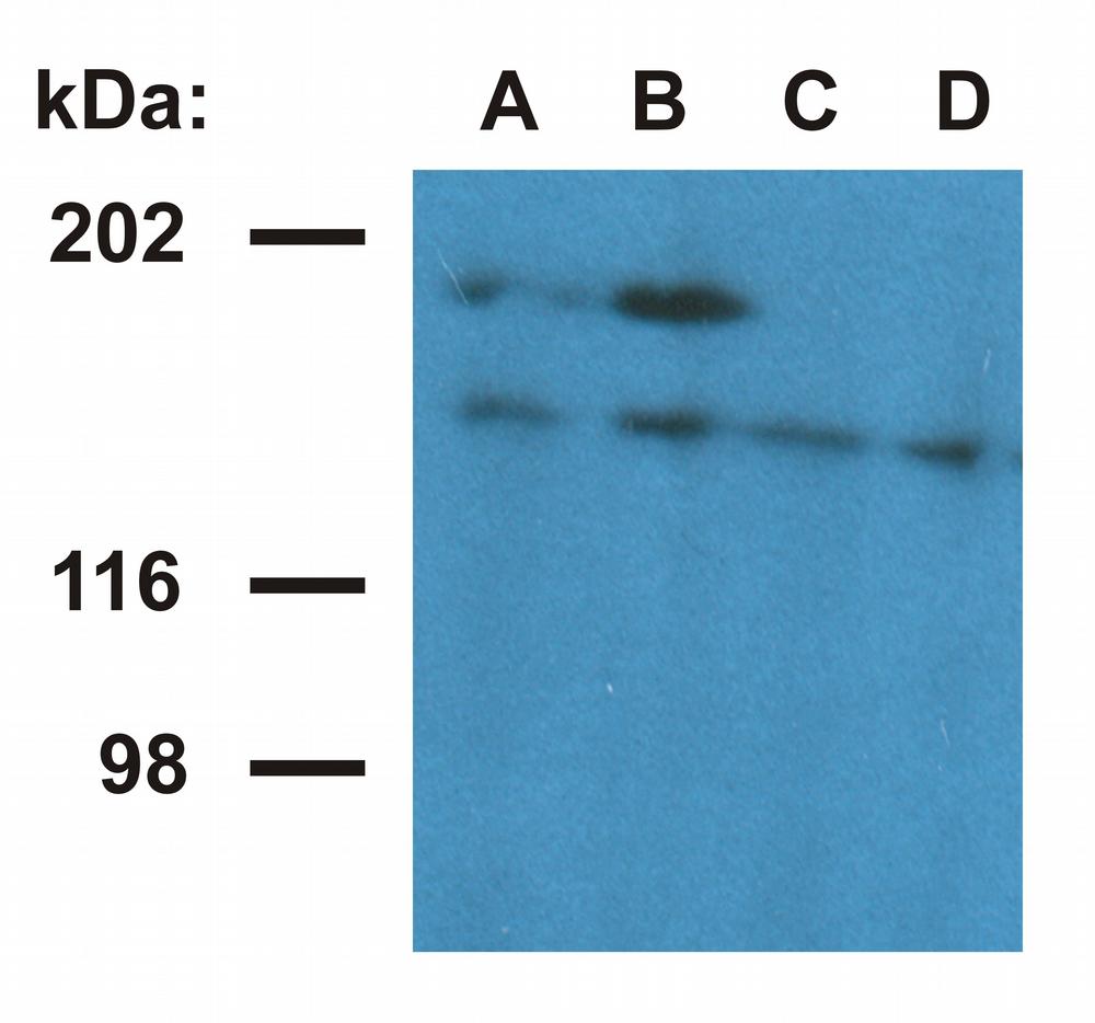 Western blotting analysis of ubinuclein in nuclear fraction of HeLa cells. The monoclonal antibody UBN1-01 (lane A, B) detects ubinuclein 1 (165 kDa) and an 180 kDa protein - presumable ubinuclein 2. The antibody UBN1-02 (lane C, D) detects ubinuclein 1. Antibody dilution: A, C - 1ug/ml; B, D - 5ug/ml.