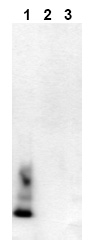 Immunoblot Analysis: Amyloid beta A4 peptides were applied on SDS-PAGE and transferred to a PVDF membrane. The Immunoblot was probed with 2 g/ml mab bA4 (40)-5C3 for 1h at 15-22C and developed by ECL (exposure time: 30 sec). Lane 1: bA4 (1-40), Lane 2: bA4
