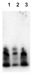 Immunoblot Analysis: Amyloid beta A4 peptides (lane 1: bA4 (1-40); lane 2: bA4 (1-42); lane 3: bA4 (1-43)) were applied on SDS-PAGE and transferred to a PVDF membrane. The immunoblot was probed with 2g/ml mab bA4N-19H5 for 1h at 15-22C and developed by ECL