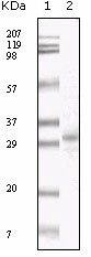 PP1 alpha antibody western blot of total rat brain homogenate. (+) indicates staining done in the presence of specific blocking peptide or (-) Peptide Control.