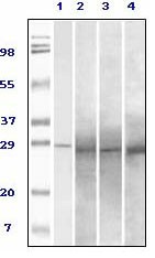 PP 1 beta antibody western blot of total rat brain homogenate. (+) indicates the presence of specific blocking peptide or (-) the presence of control peptide.