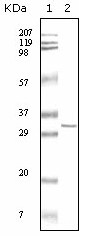 Western blot analysis using HPTR mouse mAb against truncated HPRT recombinant protein.