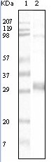 Western blot analysis using NPT mouse mAb against truncated NPT recombinant protein.