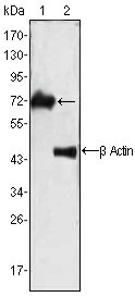 Figure 1. PP2 A/B pan 2 antibody Western blot of total rat brain extract. (+) indicates blocking specific peptide or (-) or control peptide added.