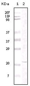 PP 2 A/B pan 2 antibody western blot of total rat brain extract. (+) indicates blocking specific peptide or (-) or control peptide added.