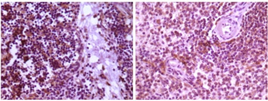 Immunohistochemical analysis of paraffin-embedded human thymoma tissue (left) and spleen tissue (right), showing cytoplasmic localization using MAP2K4 antibody Cat.-No AM06144SU-N with DAB staining.