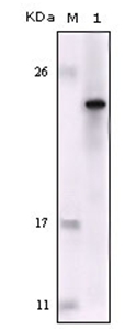 Western blot analysis using FES antibody Cat.-No AM06182SU-N against truncated FES recombinant protein.