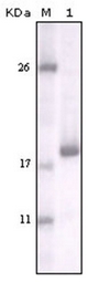Immunohistochemical staining of extraembryonic membranes from stage 16 chick embryos using TGFbetaIII receptor antibody.