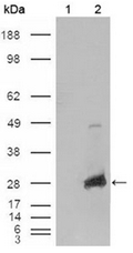 Western blot analysis using LPP3 antibody on bacterially expressed LPP3 protein when untreated (-) and treated with with 0.1 mM IPTG (isopropyl-beta-D-thiogal actopyranoside) (+) at a dilution of 10ug/ml.