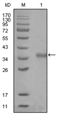 Western blot analysis using NCOR1 NCOR1 antibody Cat.-No AM06272SU-N against truncated Trx-NCOR1 recombinant protein (Lane 1).