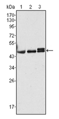 Western blot analysis using Cytokeratin 17 antibody Cat.-No AM06354SU-N against Hela (Lane 1), MCF-7 (Lane 2) and A431 (Lane 3) cell lysate.