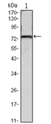 Western blot analysis using KLHL22 antibody Cat.-No AM06521SU-N against mouse brain tissues lysate.