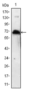 Western blot analysis using KLHL1 antibody Cat.-No AM06522SU-N against human KLHL1 (AA: 202-506) recombinant protein (Expected MW is 60.2 kDa).