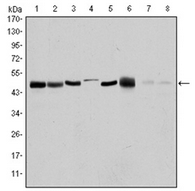 Western blot of Rat hippocampal lysate showing phospho-specific immunolabelling of the ~80 kDa doublet of 5-LO phosphorylated at Ser523