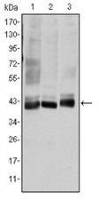 Western blot analysis using MAP2K4 antibody Cat.-No AM06580SU-N against HepG2 (1), K562 (2), and HEK293 (3) cell lysate.