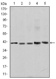 Western blot (WB) analysis of APC antibody at 1/500 dilution Lane 1:Hela cell lysate Lane 2:HEK293T cell lysate Lane 3:Rat testis tissue lysate