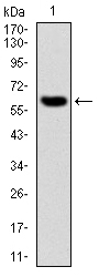 Western blot (WB) analysis of E2F-6 antibody (Cat.-No.: AP06092PU-N) at 1/500 dilution Lane 1:Hela cell lysate Lane 2:Mouse muscle tissue lysate Lane 3:Rat heart tissue lysate