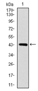 Western blot (WB) analysis of EGFR antibody (Cat.-No.: AP06098PU-N) at 1/500 dilution Lane 1:MCF-7 cell lysate Lane 2:Raw264.7 cell lysate Lane 3:PC12 cell lysate